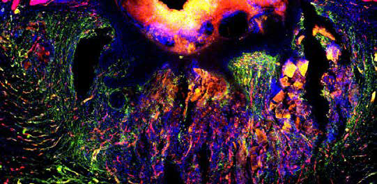 Zoomed-in photo of neonatal wound healing
